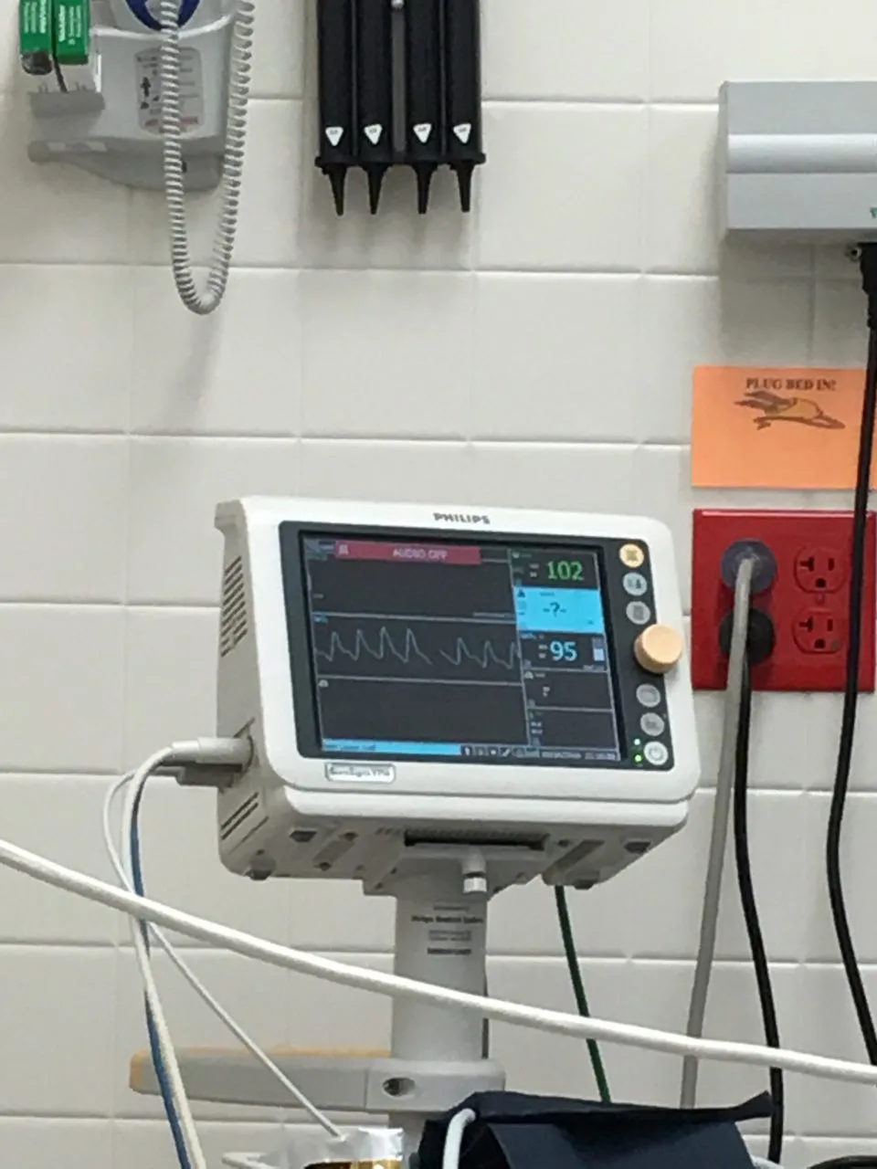 A white Philips medical monitor in a hospital room showing a heart rate of 102 and an oxygen saturation level of 95.